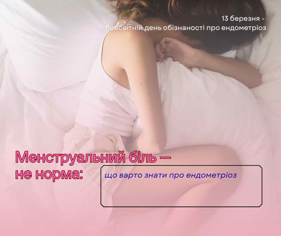 ЕНДОМЕТРІОЗ: коли клітини «подорожують» не туди 