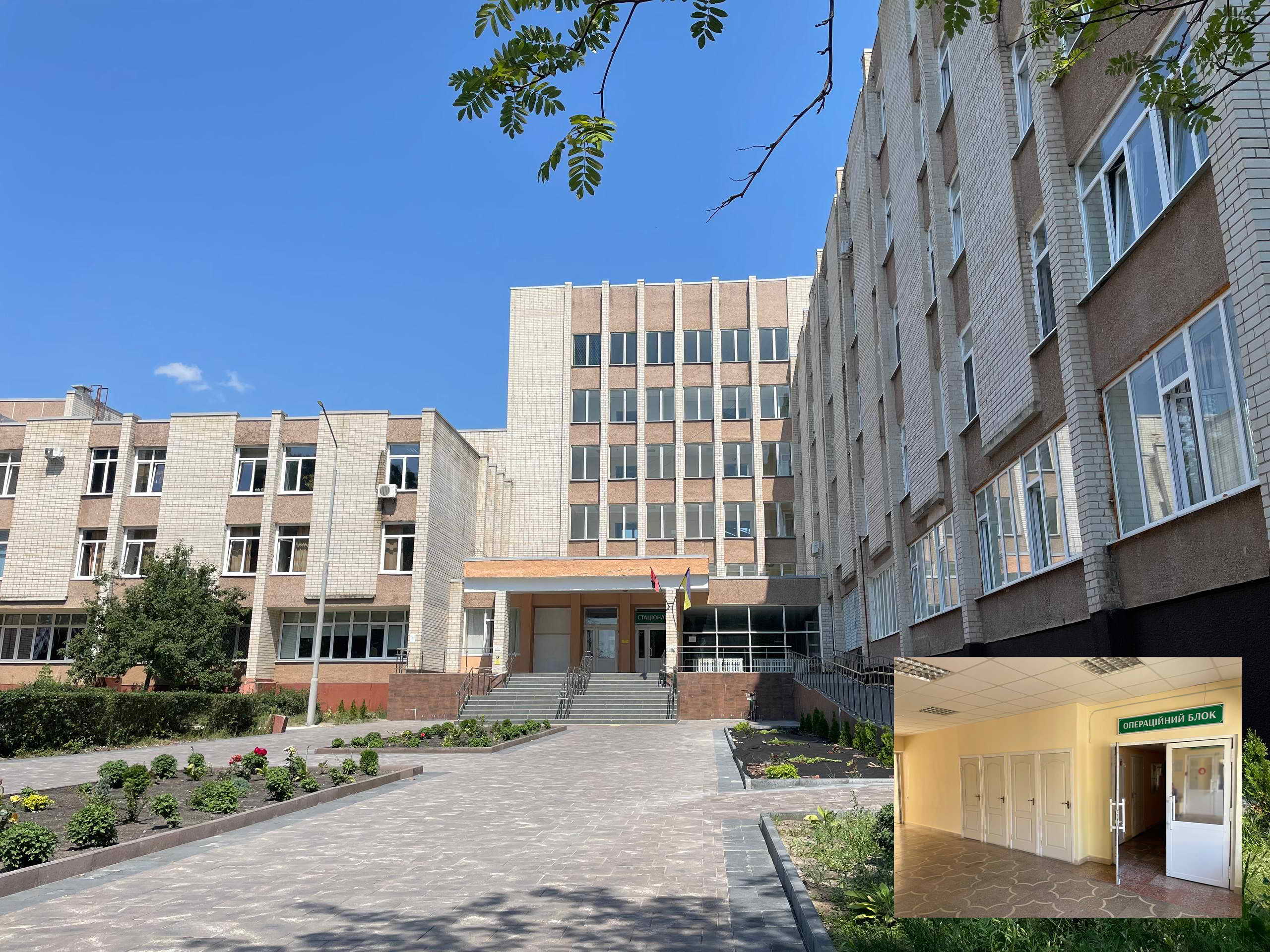 НОВА складна ОПЕРАЦІЯ ПРИ ГРИЖАХ ЖИВОТА в практиці хірургічного відділення: eTEP RS + двобічний TAR